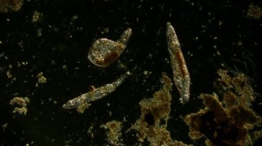 Hareket eden bakteri görüntüsü, mikroskop görüntüleri