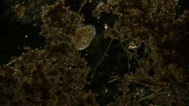 Hareket eden bakteri görüntüsü, mikroskop görüntüleri