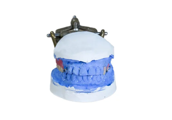 Close up denture — Stock Photo, Image