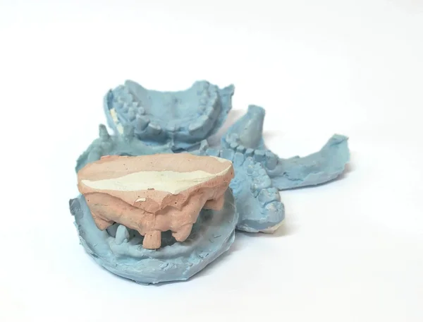 Variety of dental plaster molds — Stock Photo, Image