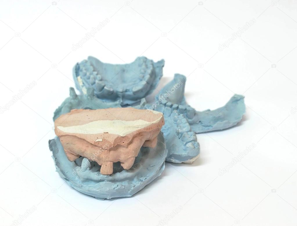 Variety of dental plaster molds