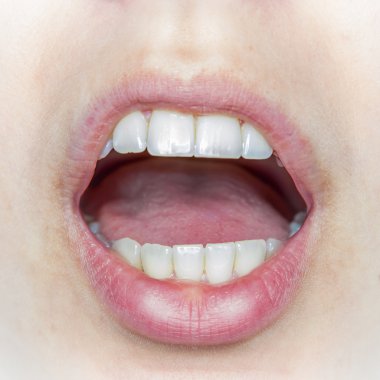 Bir buçuk doğal diş kadının ağzını açtı