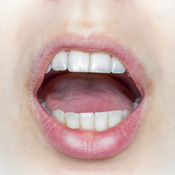 Dientes naturales en la boca de una mujer medio abierta —  Fotos de Stock