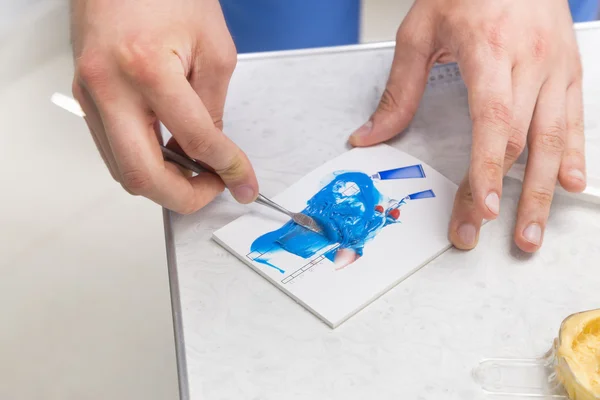 Mãos de dentista misturando material de impressão de silicone azul — Fotografia de Stock