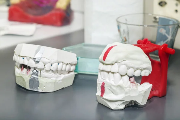 Colpi tecnici su un laboratorio di protesi dentale — Foto Stock