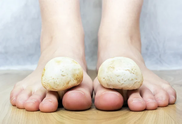 Champiñones entre los dedos de los pies imitando los dedos de los pies hongo —  Fotos de Stock