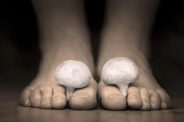 Mushrooms between the toes feet imitating toes fungus — Stock Photo, Image