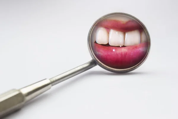 Dentist mirror with reflection of teeth — Stock Photo, Image