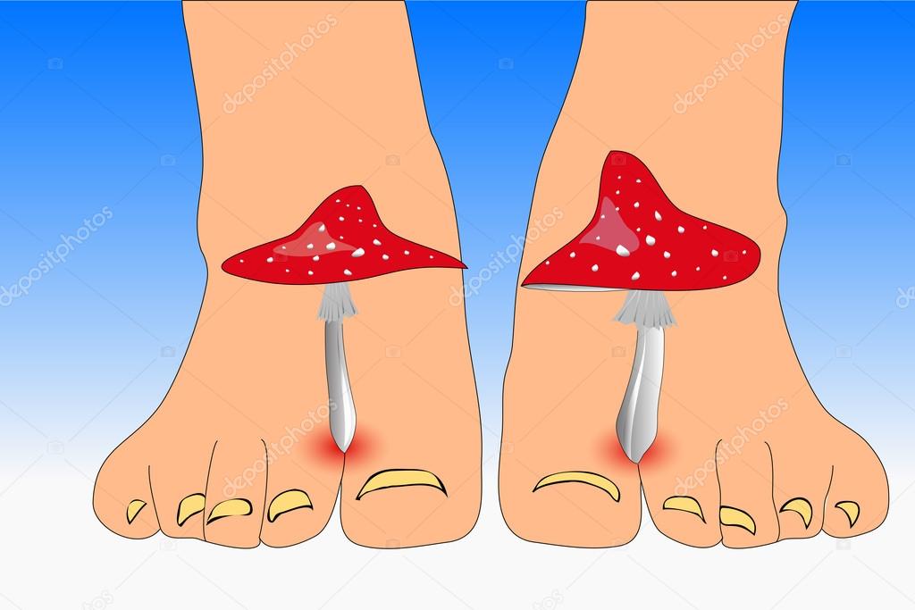 Amanita mushrooms between the toes feet imitating toes fungus