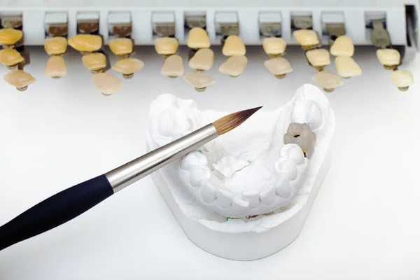 Технічні знімки моделі на стоматологічній протезній лабораторії — стокове фото