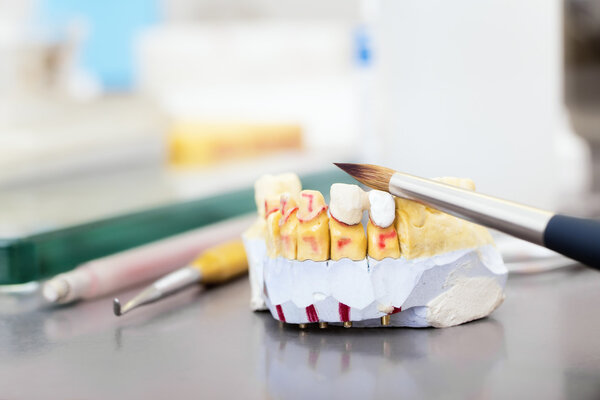 Technical shots of model on a dental prothetic laboratory 