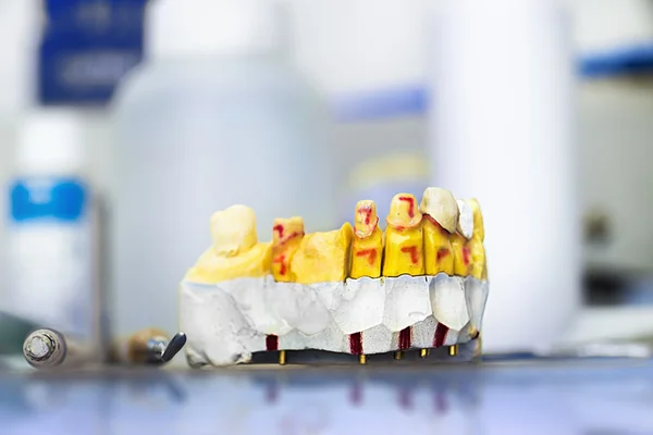 Inyecciones técnicas en un laboratorio protésico dental —  Fotos de Stock