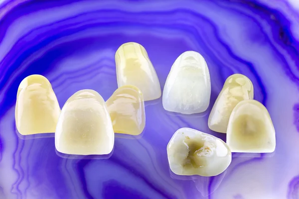 Eight Ceramic Dentures Agat Stone — Stock Photo, Image