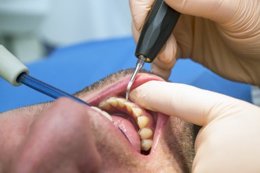 Dentist making patient's teeth hygiene clipart