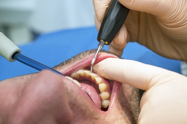 Dentiste faisant l'hygiène des dents du patient — Photo