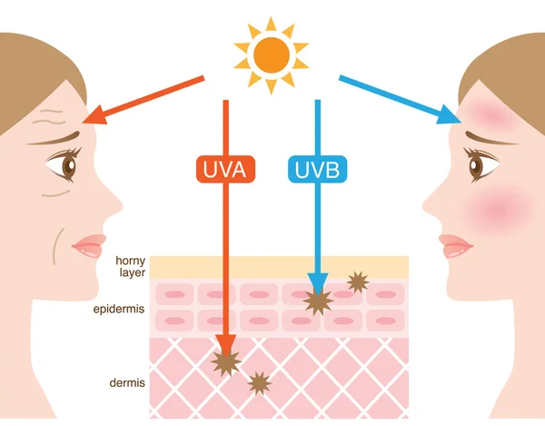 Infographic skin illustration. the difference between UVA and UVB rays penetration — Stock Vector