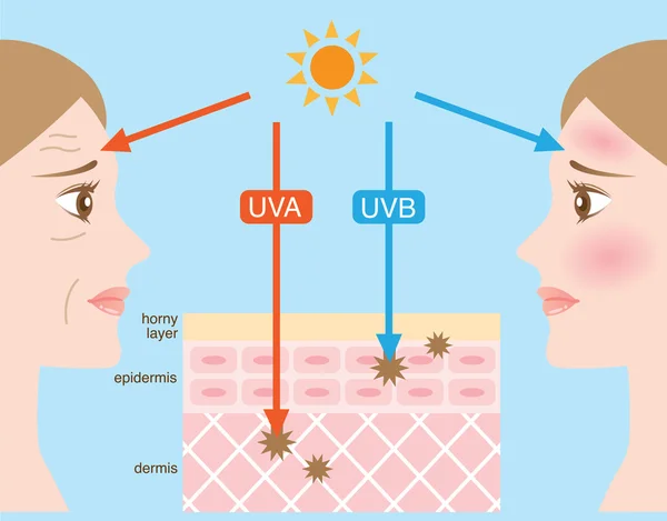 Infographic skin illustration. the difference between UVA and UVB rays penetration — Stock Vector