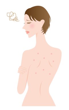 sırt sivilce kadın