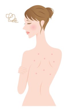 sırt sivilce kadın