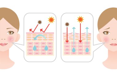 infografik cilt illüstrasyon. kuru cilt ve sağlıklı cilt