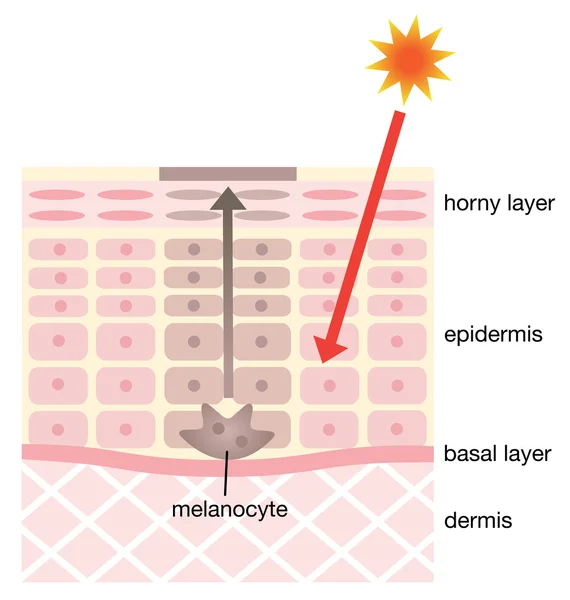 Infographic Skin illustratie. huid mechanisme van gezichts vlekken — Stockvector