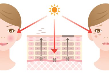 infographic skin illustration. skin spot mechanism clipart