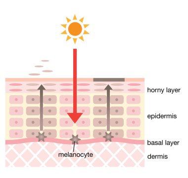 infographic skin illustration. skin spot mechanism clipart