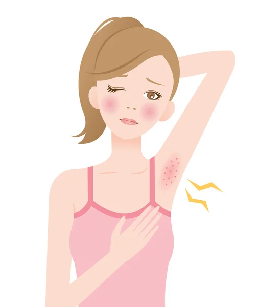 Underarm red rash — Stock Vector