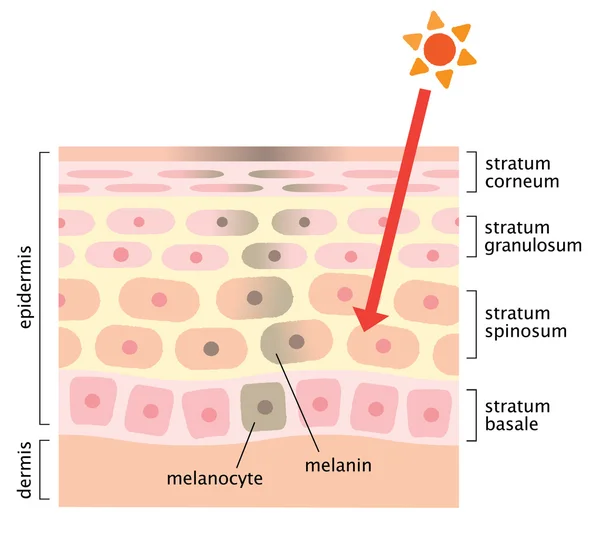 Infographic Skin illustratie. huid mechanisme van gezichts vlekken — Stockvector