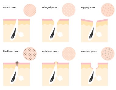 diagram of skin pores clipart