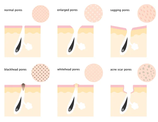 Diagram of skin pores — Stock Vector