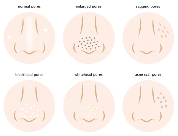 Diagram of skin pores — Stock Vector