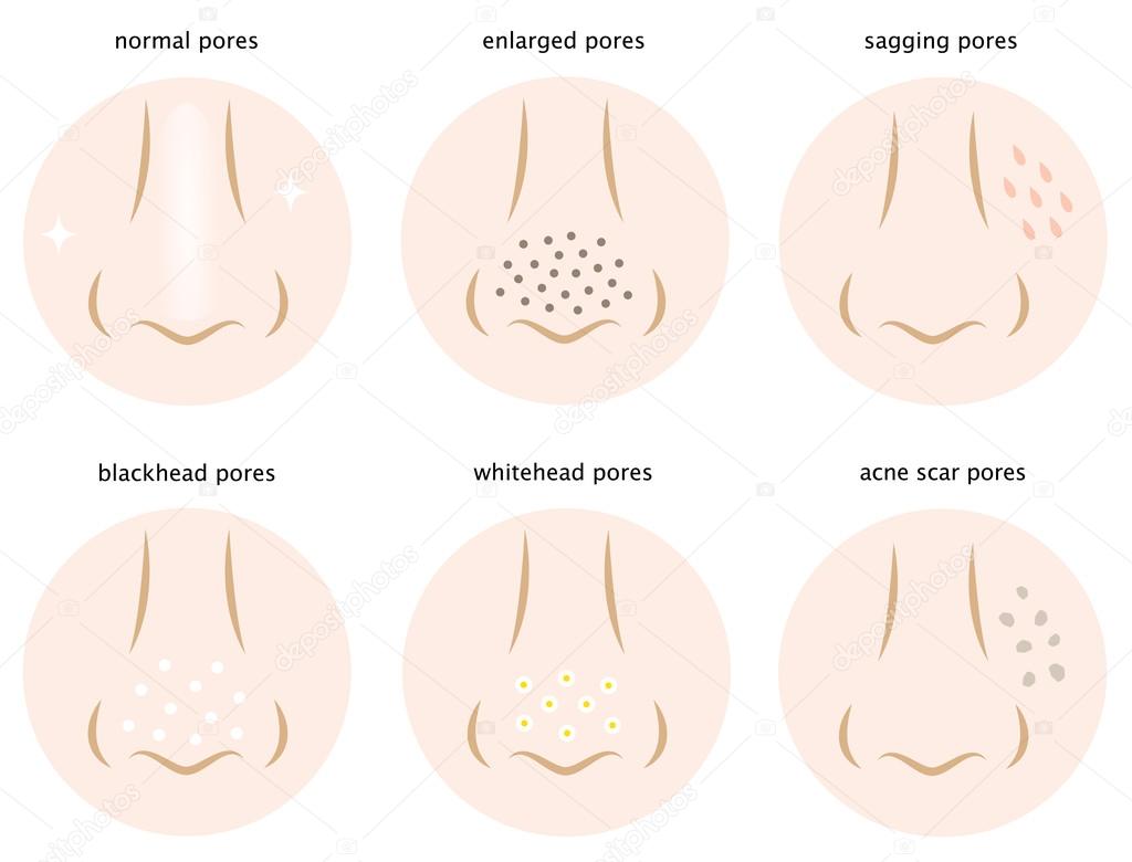 diagram of skin pores