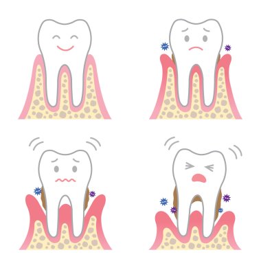 periodontal disease symptoms clipart