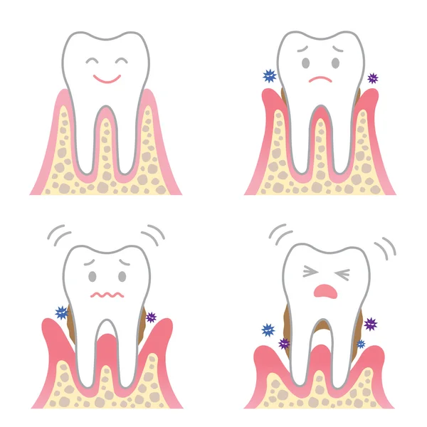 Symptômes de maladie parodontale — Image vectorielle