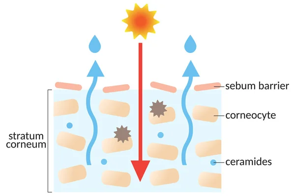 Trockene Hautschicht Mit Stratum Corneum Und Ceramiden Illustration Schönheits Und — Stockvektor