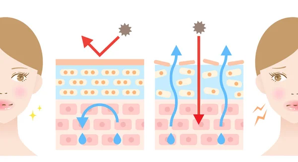 Strato Pelle Secca Sana Illustrazione Della Donna Prima Dopo Concetto — Vettoriale Stock