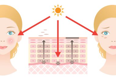 Melanin diyagramı, yüzü koyu lekeler ve kadın yüzü. Güzellik ve cilt bakımı