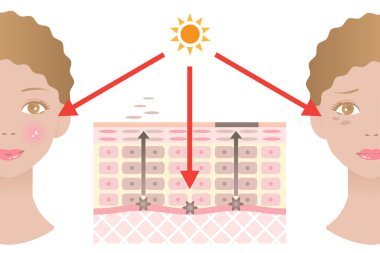 Melanin diyagramı, yüzü koyu lekeler ve kadın yüzü. Güzellik ve cilt bakımı