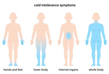 İnsan vücudunda soğuk hassasiyet belirtileri. Sağlık hizmeti kavramı
