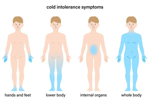 Συμπτώματα Ψυχρής Ευαισθησίας Ανθρώπινο Σώμα Έννοια Υγειονομικής Περίθαλψης — Διανυσματικό Αρχείο