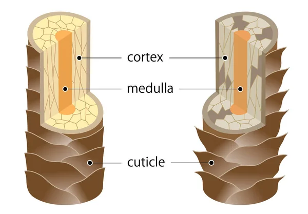 Laag Van Gezonde Beschadigde Haarstructuur Haarschacht Bestaat Uit Cortex Cuticula — Stockvector