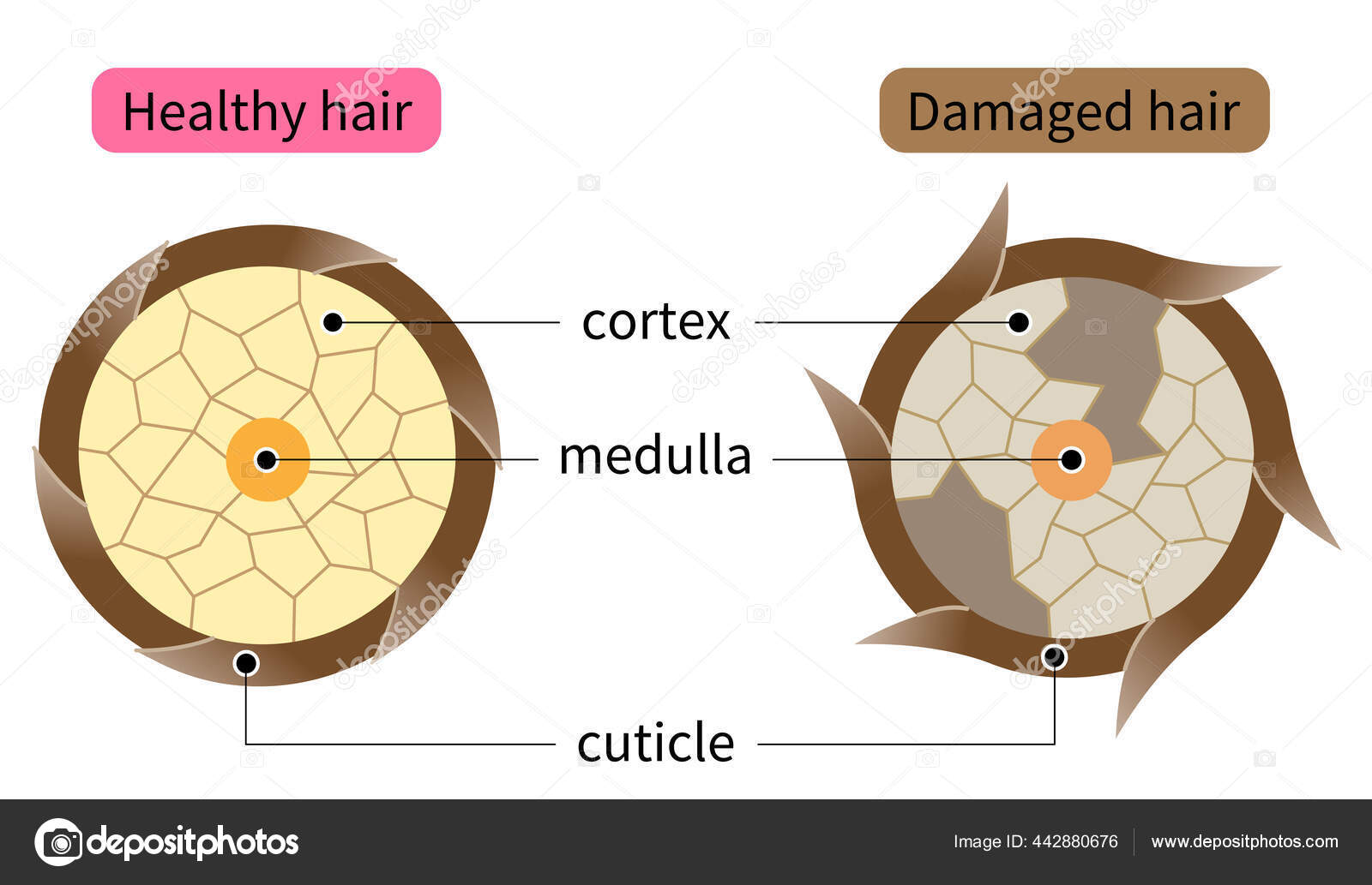 Layer Healthy Damaged Hair Structure Hair Shaft Consists Cortex Cuticle  Stock Vector Image by ©mug5 #442880676