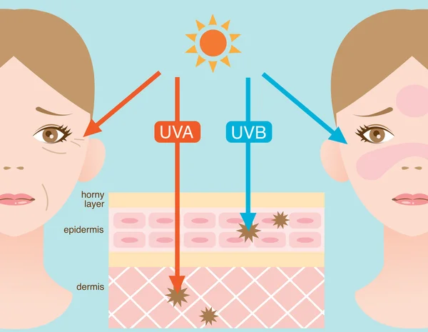 Ilustração infográfica da pele. a diferença entre a penetração dos raios UVA e UVB —  Vetores de Stock