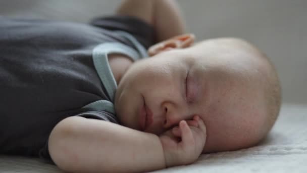 Closeup bebê dormindo com dermatite na testa do rosto infantil em cobertor branco — Vídeo de Stock