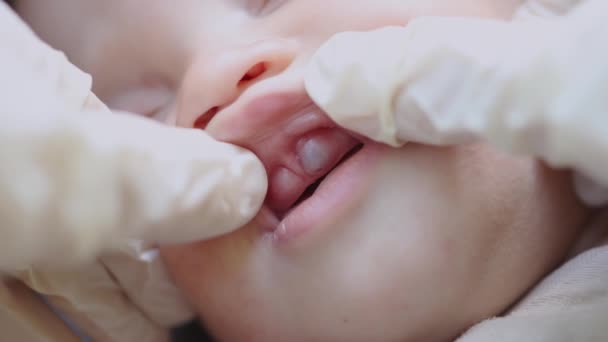 Mãos verificando boca de um bebê dormindo com inchado azul goma leite dentes erupção — Vídeo de Stock