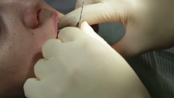 Dentist makes a mold of teeth — Stock Video