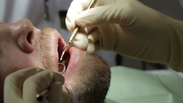 Обследование зубов после лечения — стоковое видео
