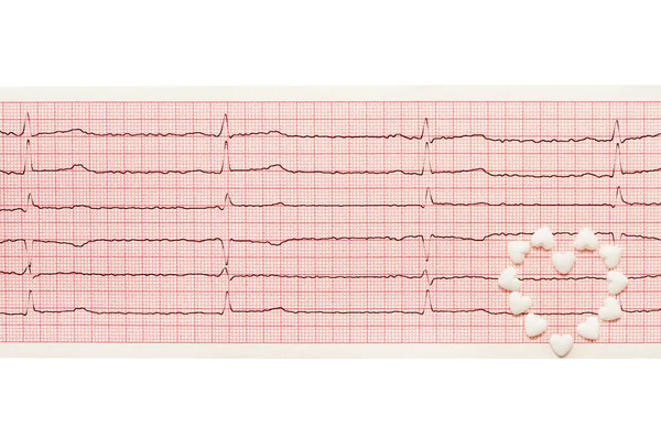 Heart made of white heart shape tablets on paper ECG results
