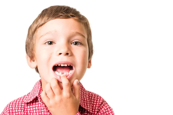 白い背景に孤立した口を開けて乳歯を失った若い愛らしい少年 — ストック写真